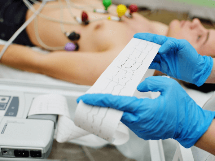 Registro de un electrocardiograma: electrodos en el pecho del paciente y la tira de papel con el trazo