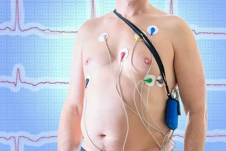 holter cardiaco donde hacerlo