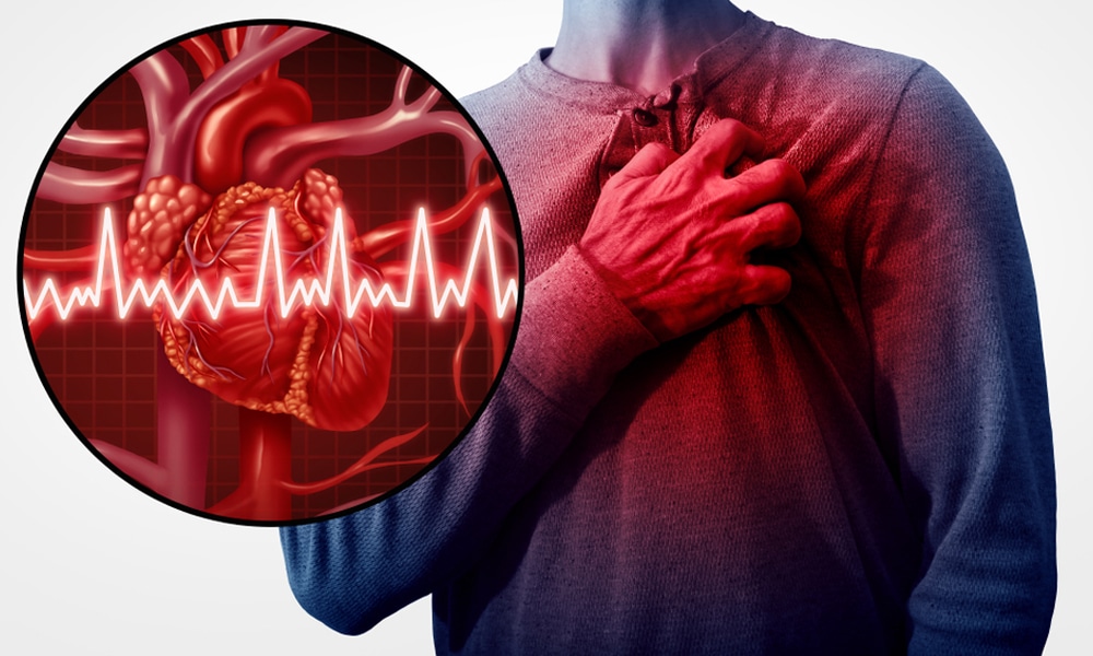 especialista en arritmias