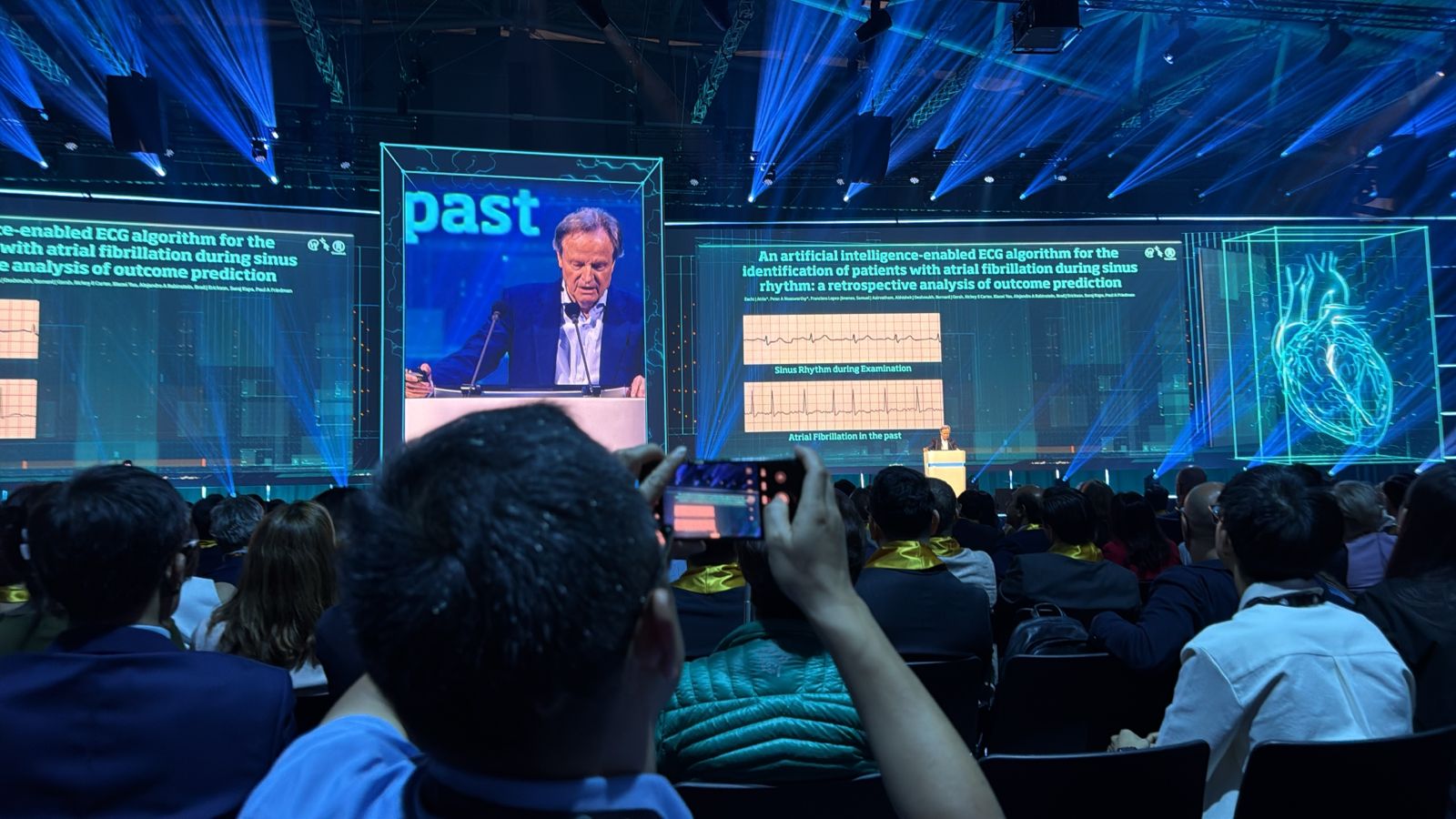 Novedades en cardiología 2026: sesión del ESC Congress 2026 en Múnich sobre inteligencia artificial y electrocardiograma para la fibrilación auricular.