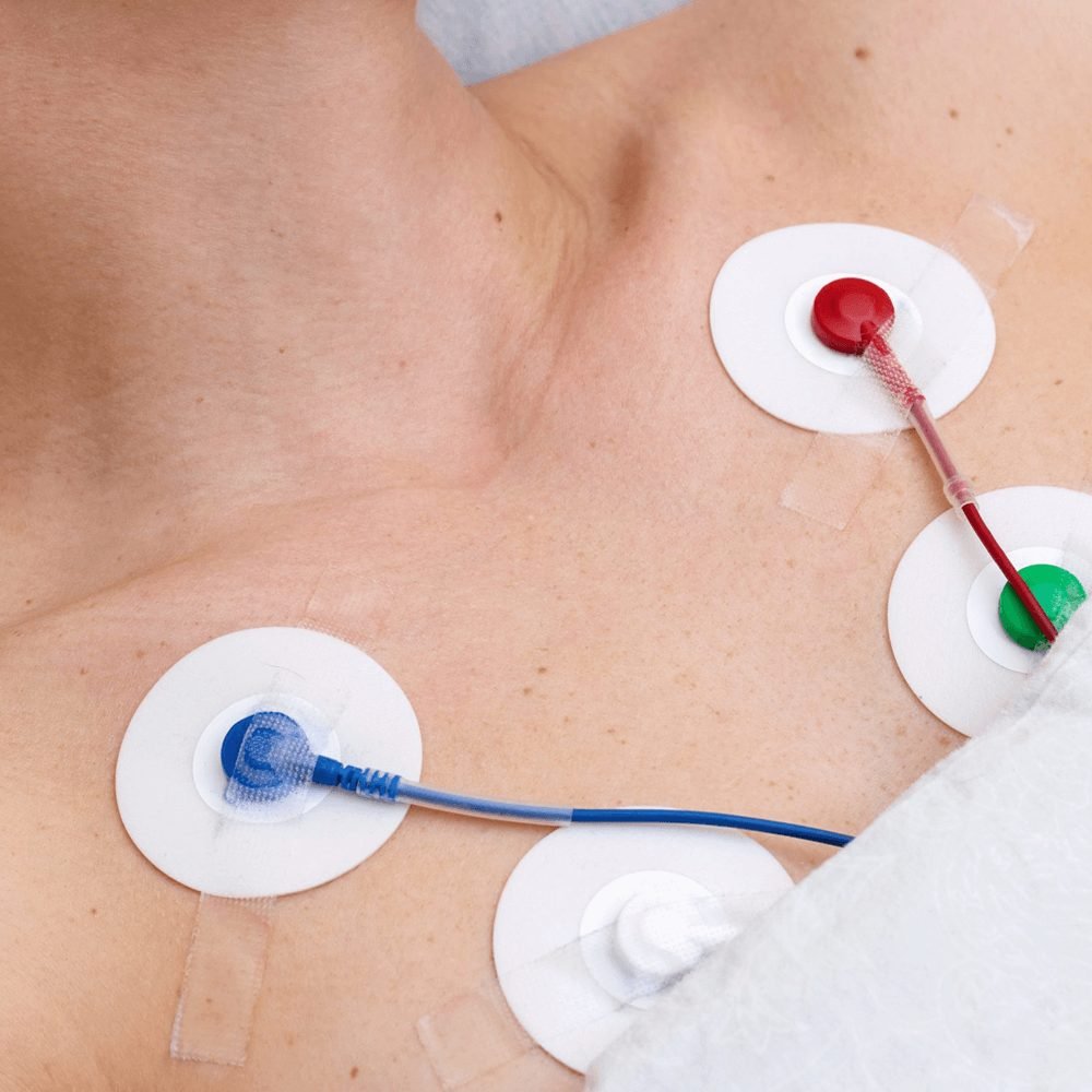 Electrodos de registro cardiaco colocados en el pecho de un paciente